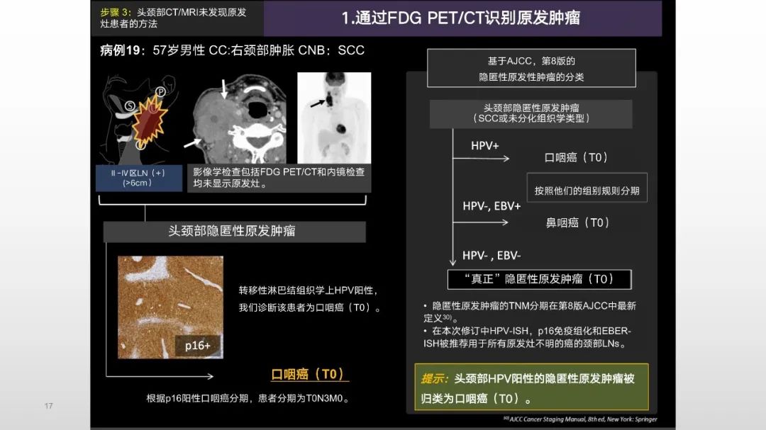 影像PPT - 【PPT】原发肿瘤在哪里？不明原发肿瘤颈部淋巴结转移的影像学检查方法-15