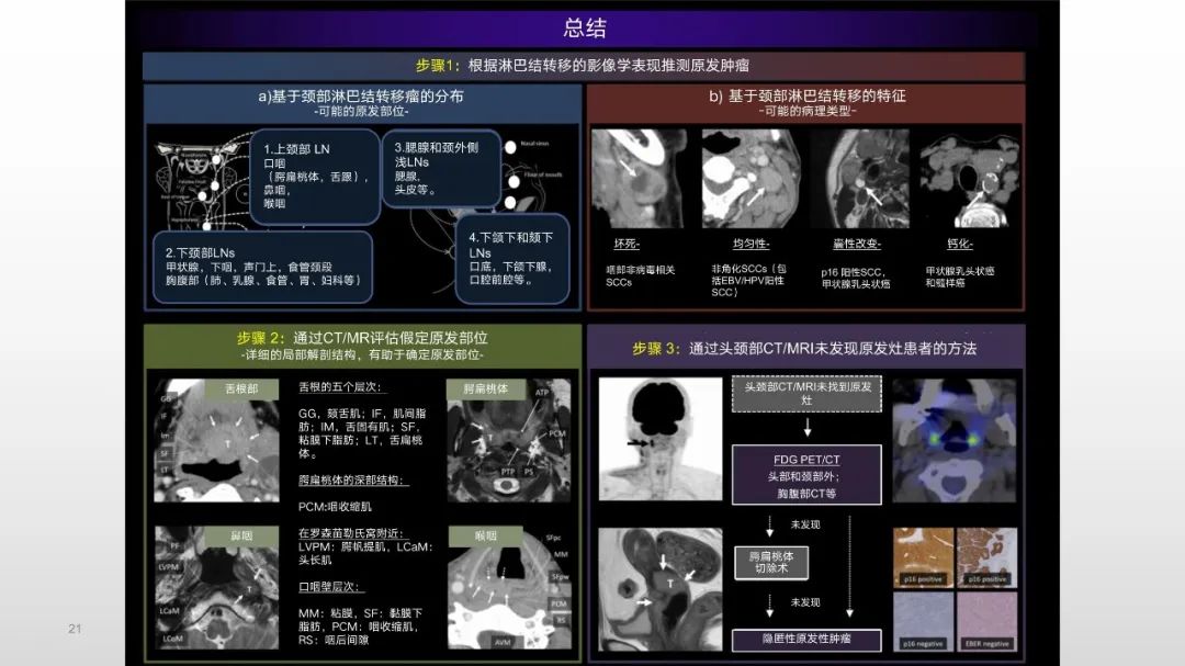 影像PPT - 【PPT】原发肿瘤在哪里？不明原发肿瘤颈部淋巴结转移的影像学检查方法-19