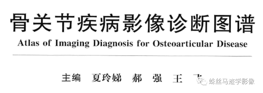 影像PPT - SAPHO综合征-3 影像PPT - SAPHO综合征-3