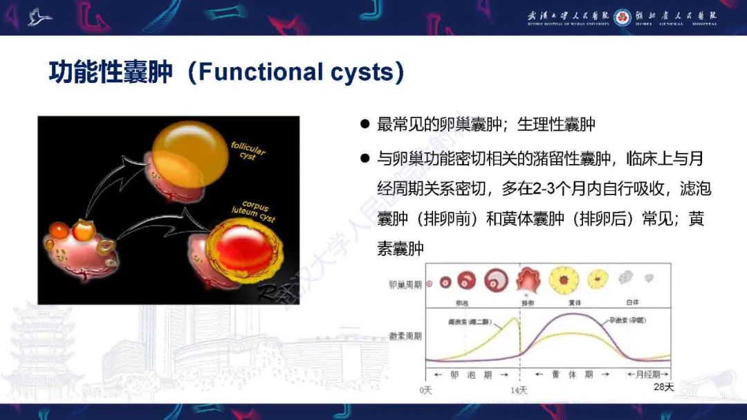 影像PPT - 【PPT】卵巢囊性病变影像诊断思路-12