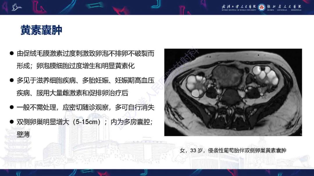 影像PPT - 【PPT】卵巢囊性病变影像诊断思路-16
