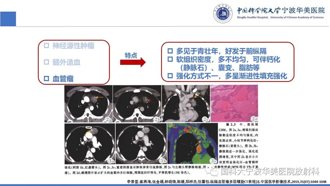影像PPT - 【病例】纵隔海绵状血管瘤1例CT影像-10