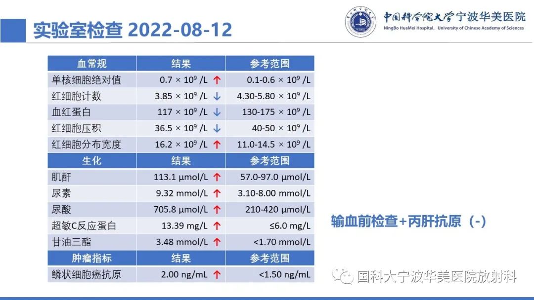 影像PPT - 【PPT】肝脏上皮样血管平滑肌脂肪瘤-3