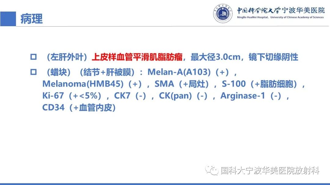 影像PPT - 【PPT】肝脏上皮样血管平滑肌脂肪瘤-13