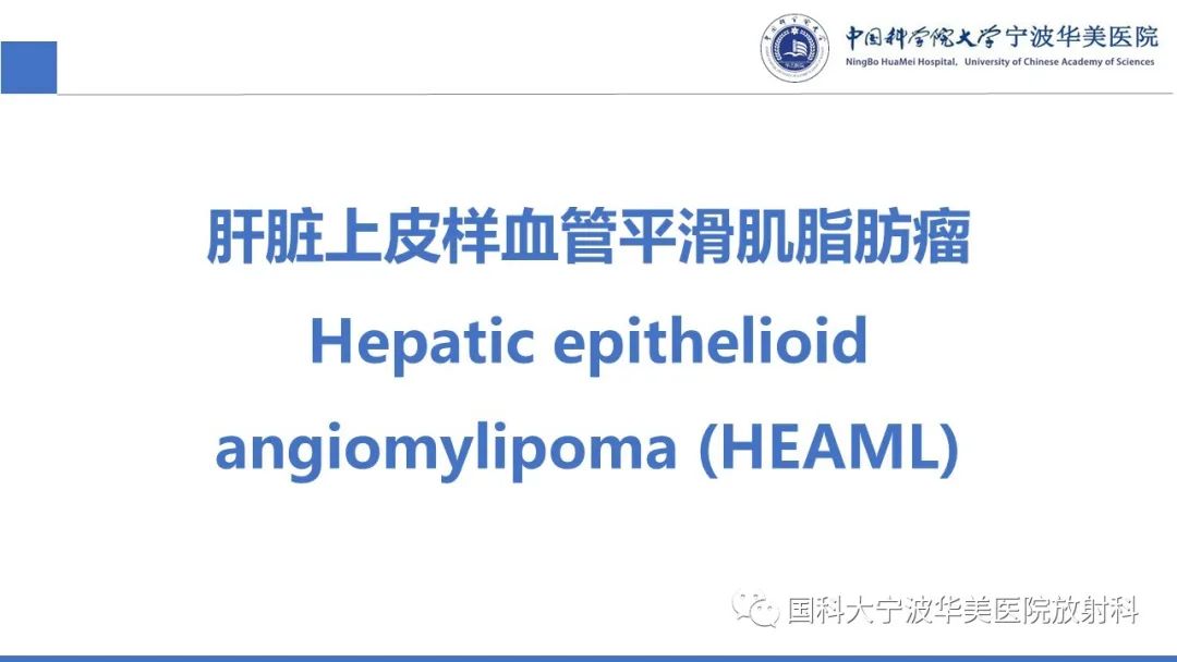 影像PPT - 【PPT】肝脏上皮样血管平滑肌脂肪瘤-14