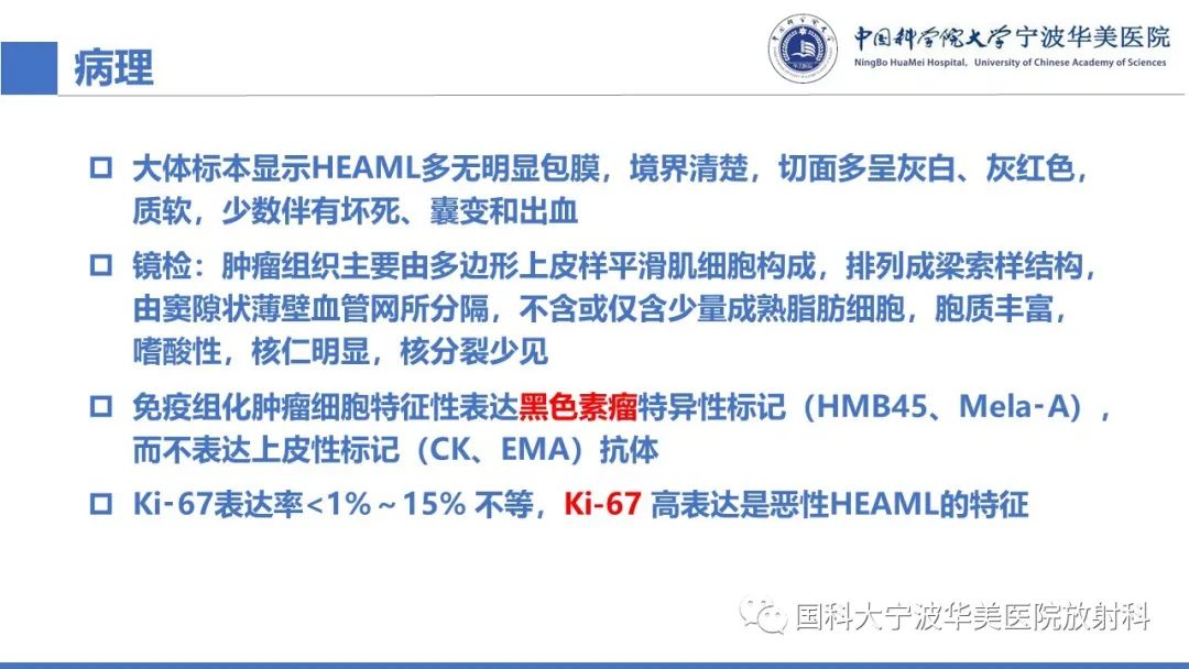 影像PPT - 【PPT】肝脏上皮样血管平滑肌脂肪瘤-16