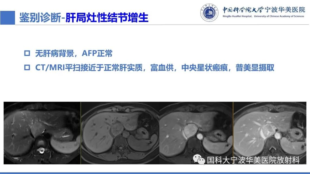 影像PPT - 【PPT】肝脏上皮样血管平滑肌脂肪瘤-27