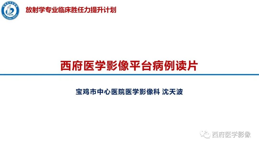 影像PPT - 【病例】胆管癌1例CT及MR影像-1