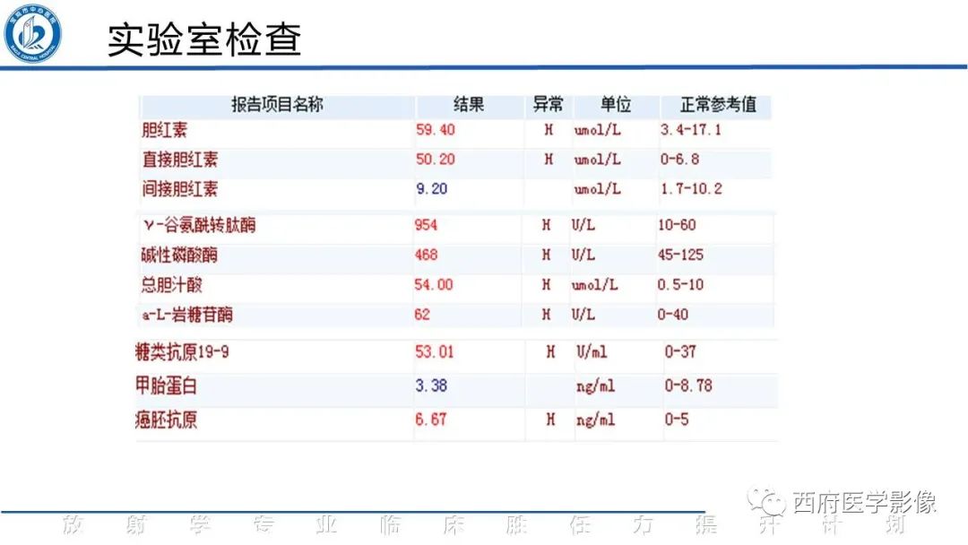 影像PPT - 【病例】胆管癌1例CT及MR影像-3