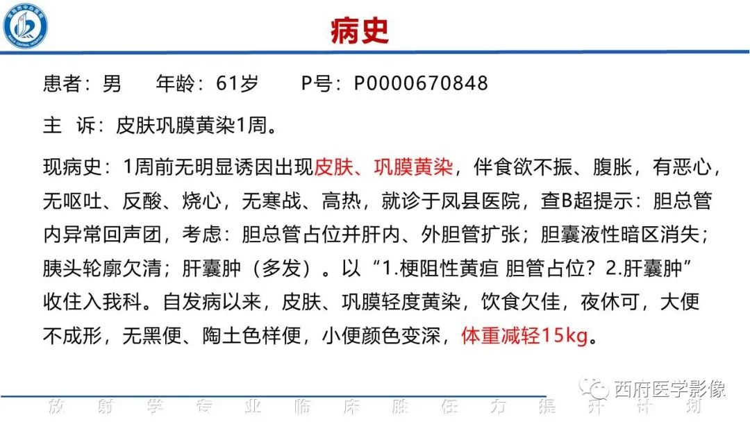 影像PPT - 【病例】胆管癌1例CT及MR影像-2