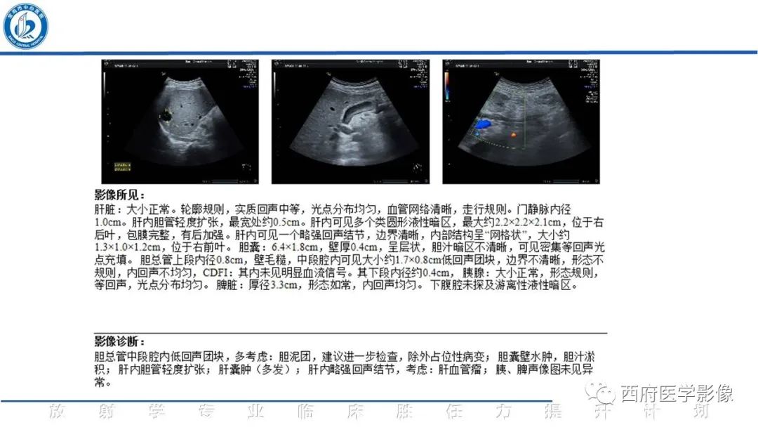 影像PPT - 【病例】胆管癌1例CT及MR影像-4