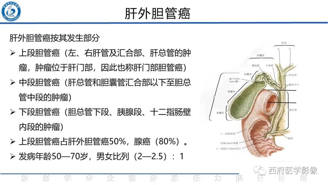 影像PPT - 【病例】胆管癌1例CT及MR影像-16