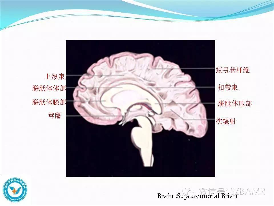 影像PPT - 【PPT】大脑白质纤维束解剖应用-6