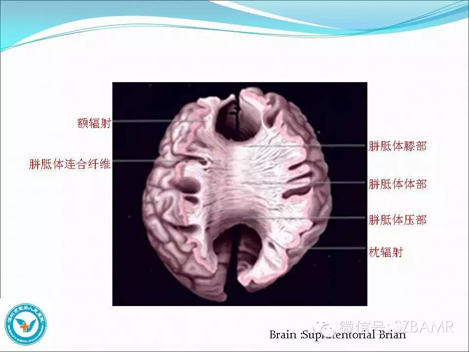 影像PPT - 【PPT】大脑白质纤维束解剖应用-7