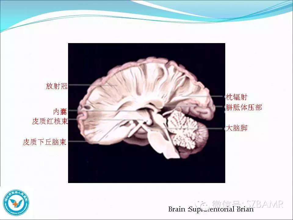 影像PPT - 【PPT】大脑白质纤维束解剖应用-8
