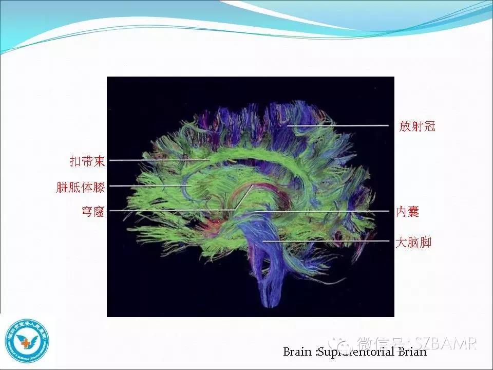 影像PPT - 【PPT】大脑白质纤维束解剖应用-10