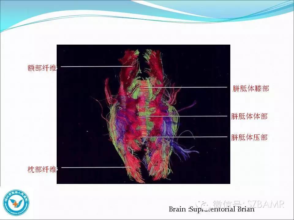 影像PPT - 【PPT】大脑白质纤维束解剖应用-12