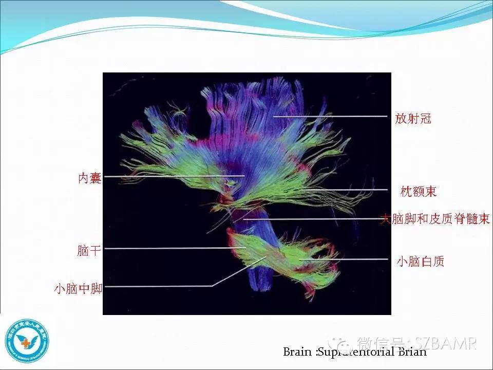 影像PPT - 【PPT】大脑白质纤维束解剖应用-11