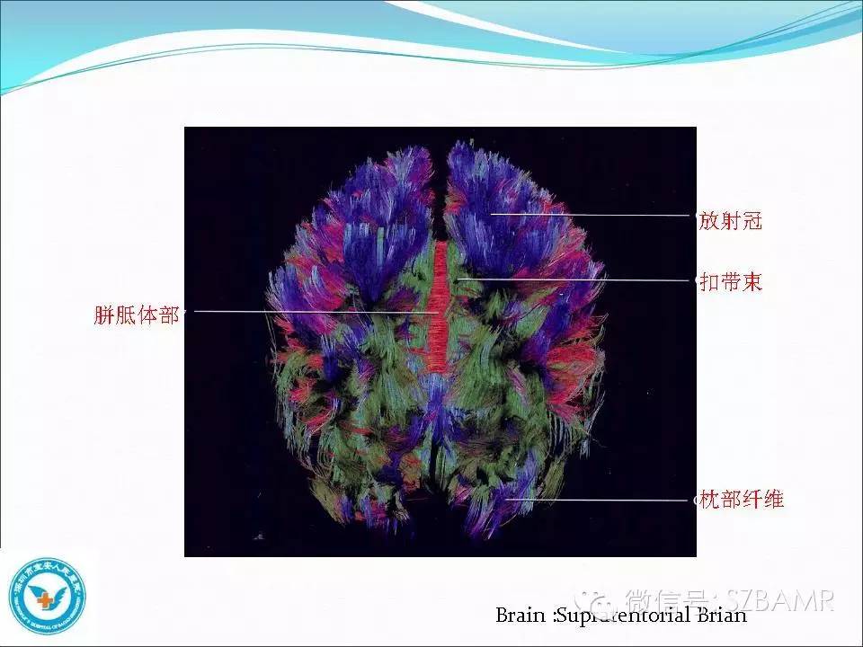 影像PPT - 【PPT】大脑白质纤维束解剖应用-13