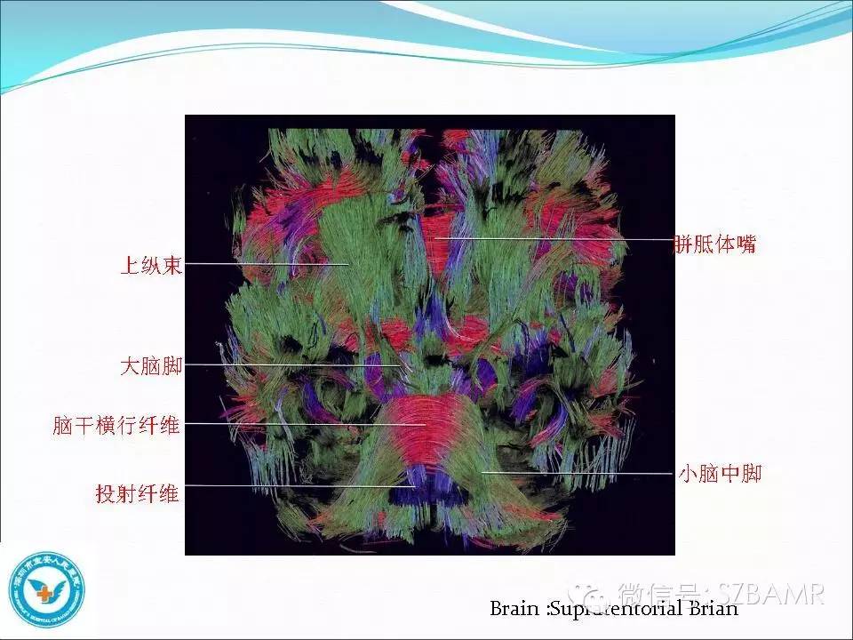 影像PPT - 【PPT】大脑白质纤维束解剖应用-14