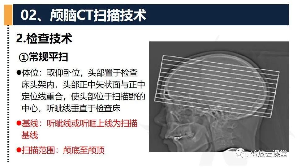 影像PPT - 【PPT】CT检查技术-13