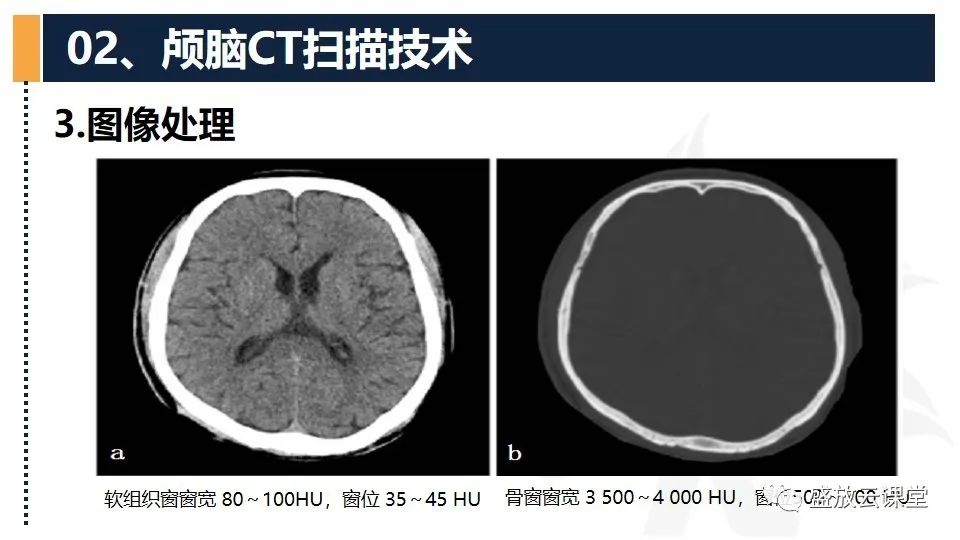 影像PPT - 【PPT】CT检查技术-17