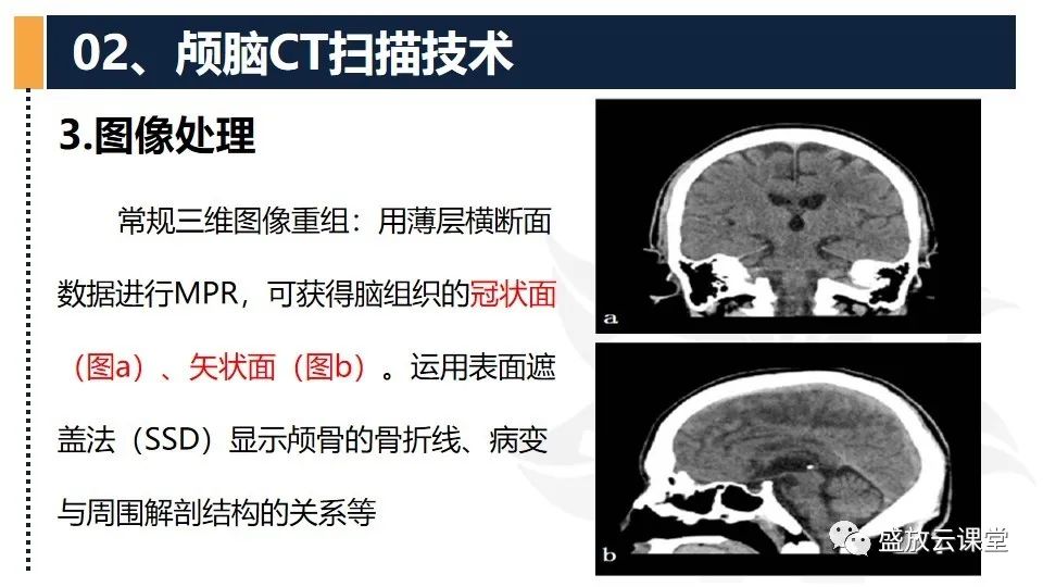 影像PPT - 【PPT】CT检查技术-18
