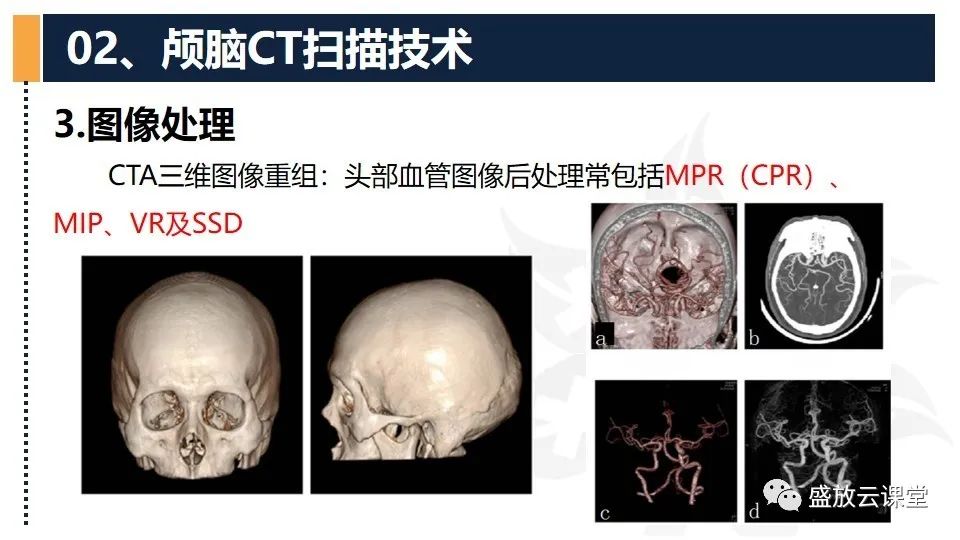 影像PPT - 【PPT】CT检查技术-19