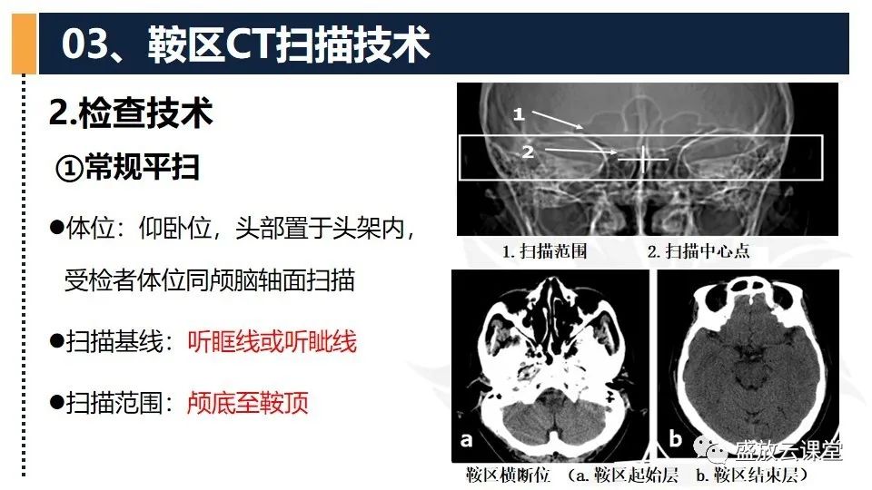 影像PPT - 【PPT】CT检查技术-22