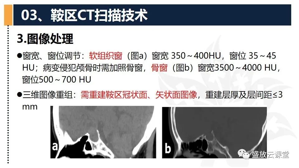 影像PPT - 【PPT】CT检查技术-25
