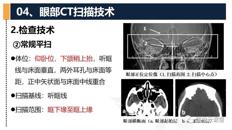 影像PPT - 【PPT】CT检查技术-28