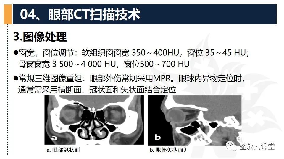 影像PPT - 【PPT】CT检查技术-31