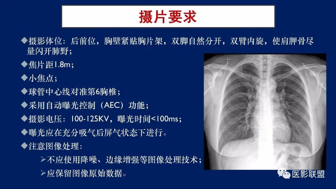 影像PPT - 【PPT】如何精准解读尘肺X片及诊断-13