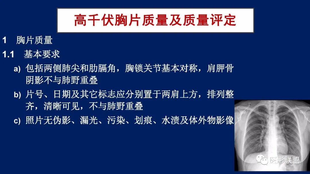 影像PPT - 【PPT】如何精准解读尘肺X片及诊断-14