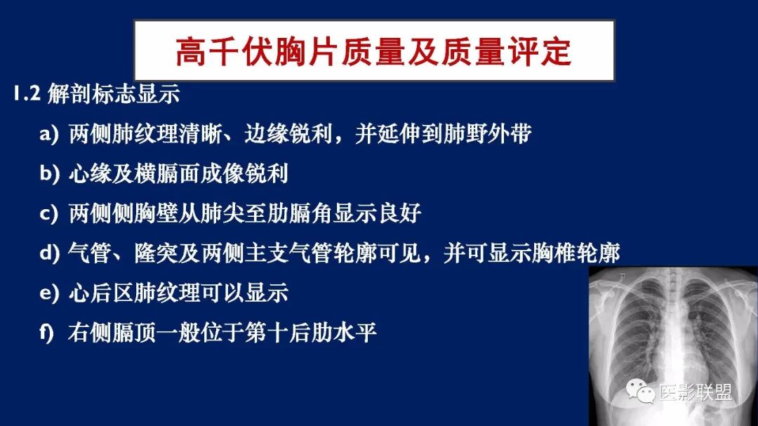 影像PPT - 【PPT】如何精准解读尘肺X片及诊断-15