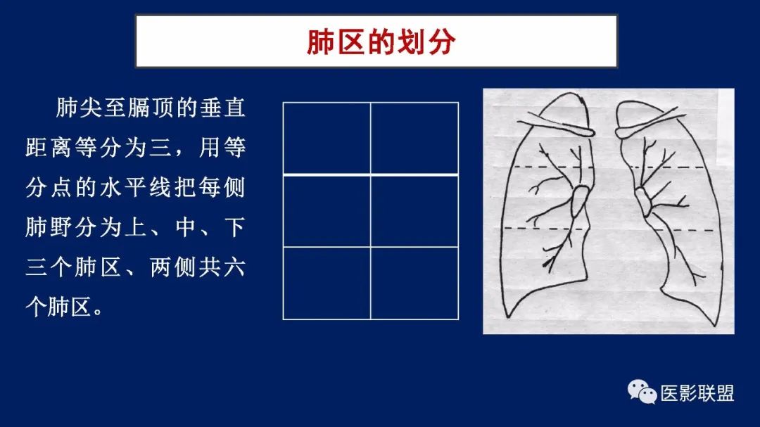 影像PPT - 【PPT】如何精准解读尘肺X片及诊断-32