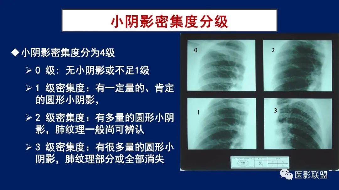 影像PPT - 【PPT】如何精准解读尘肺X片及诊断-35