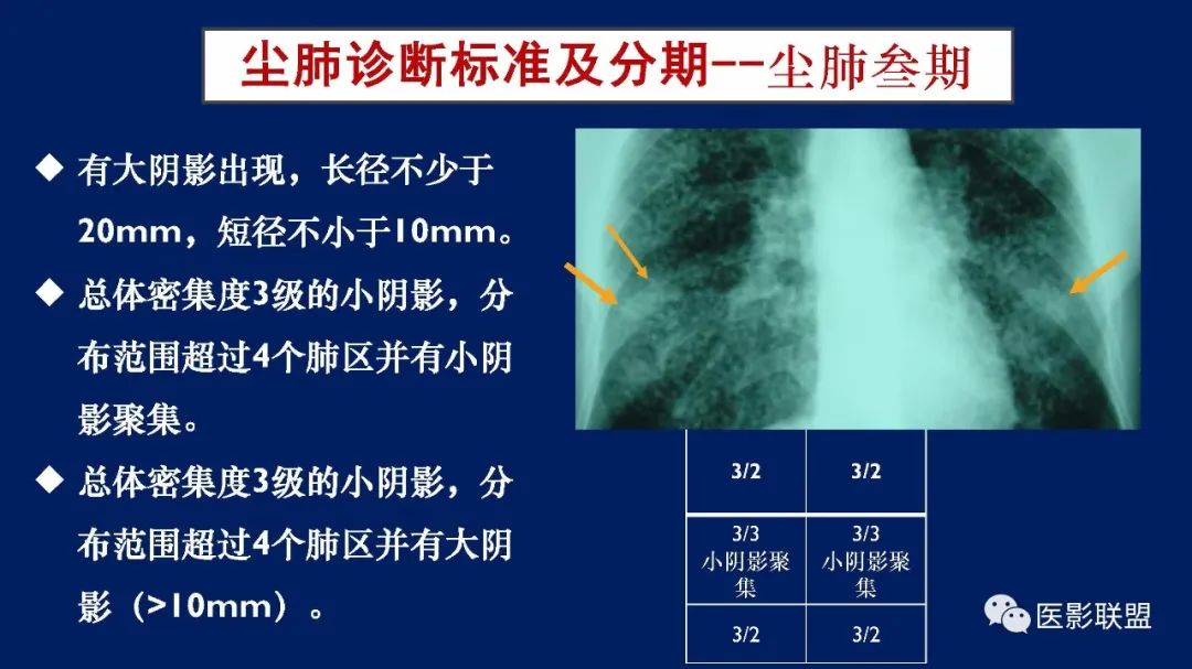 影像PPT - 【PPT】如何精准解读尘肺X片及诊断-43