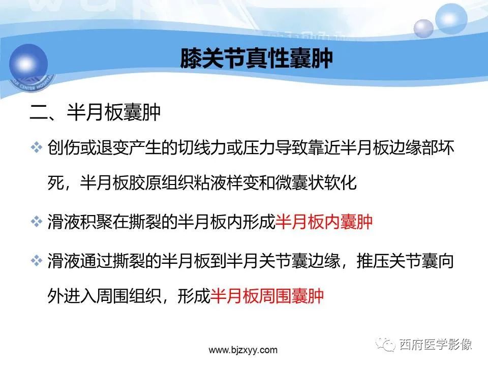 影像PPT - 【PPT】膝关节囊性病变影像诊断-13