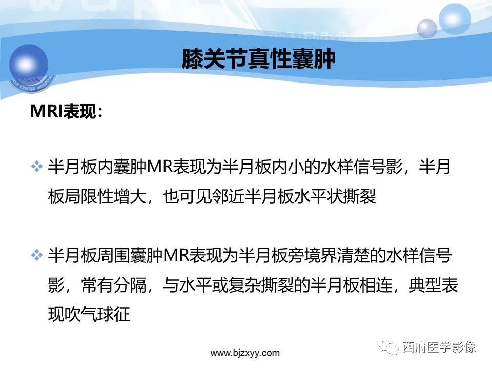 影像PPT - 【PPT】膝关节囊性病变影像诊断-14