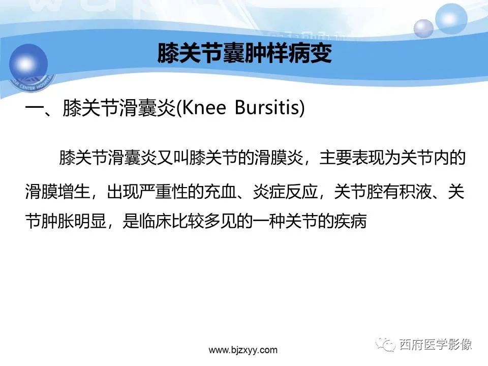 影像PPT - 【PPT】膝关节囊性病变影像诊断-29