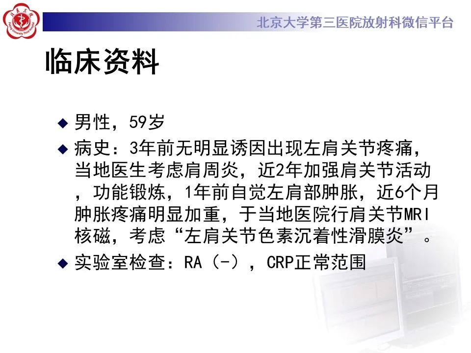 影像PPT - 【PPT】滑膜软骨瘤病-2