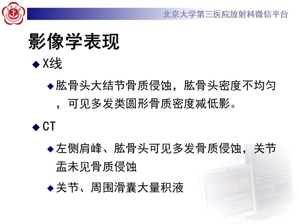 影像PPT - 【PPT】滑膜软骨瘤病-9