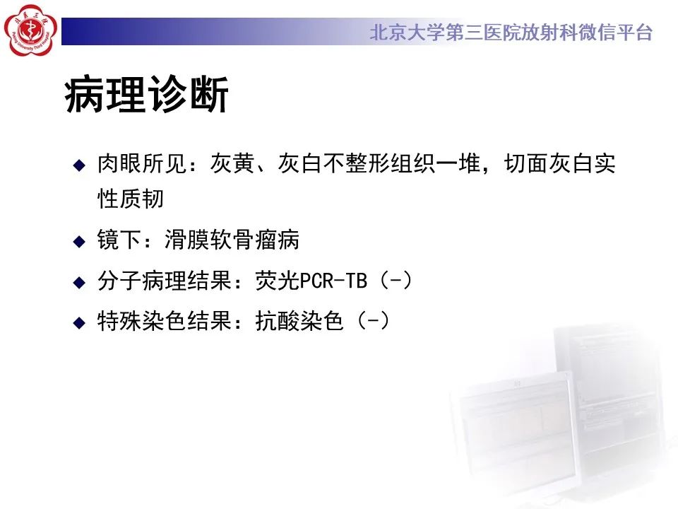 影像PPT - 【PPT】滑膜软骨瘤病-17