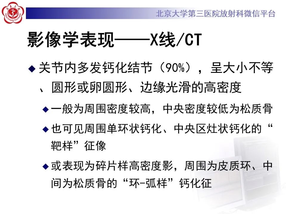 影像PPT - 【PPT】滑膜软骨瘤病-29