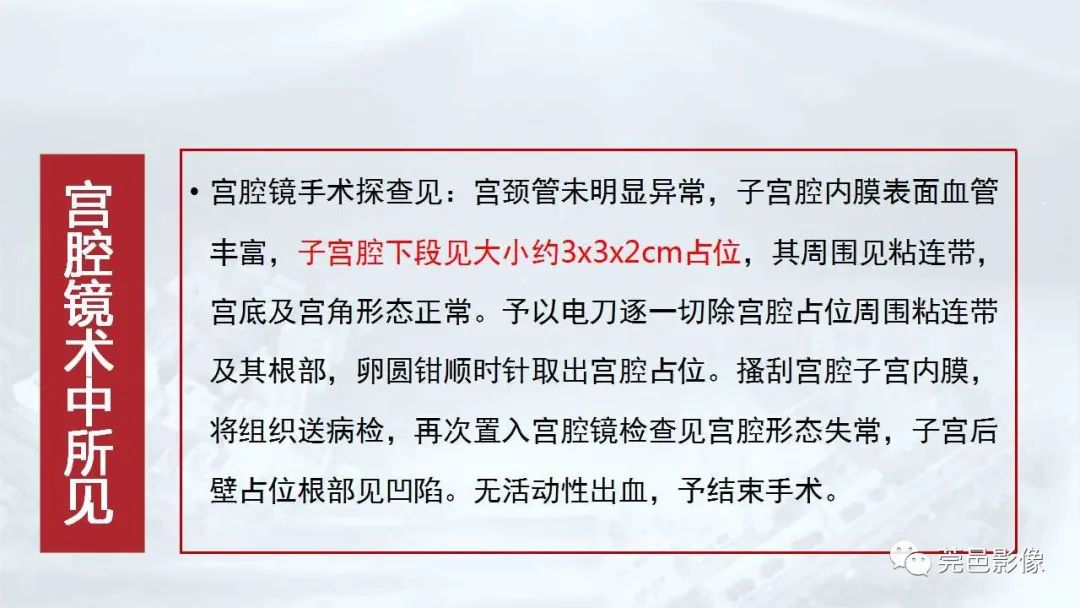 影像PPT - 【病例】一例肺良性转移性平滑肌瘤及文献复习-5