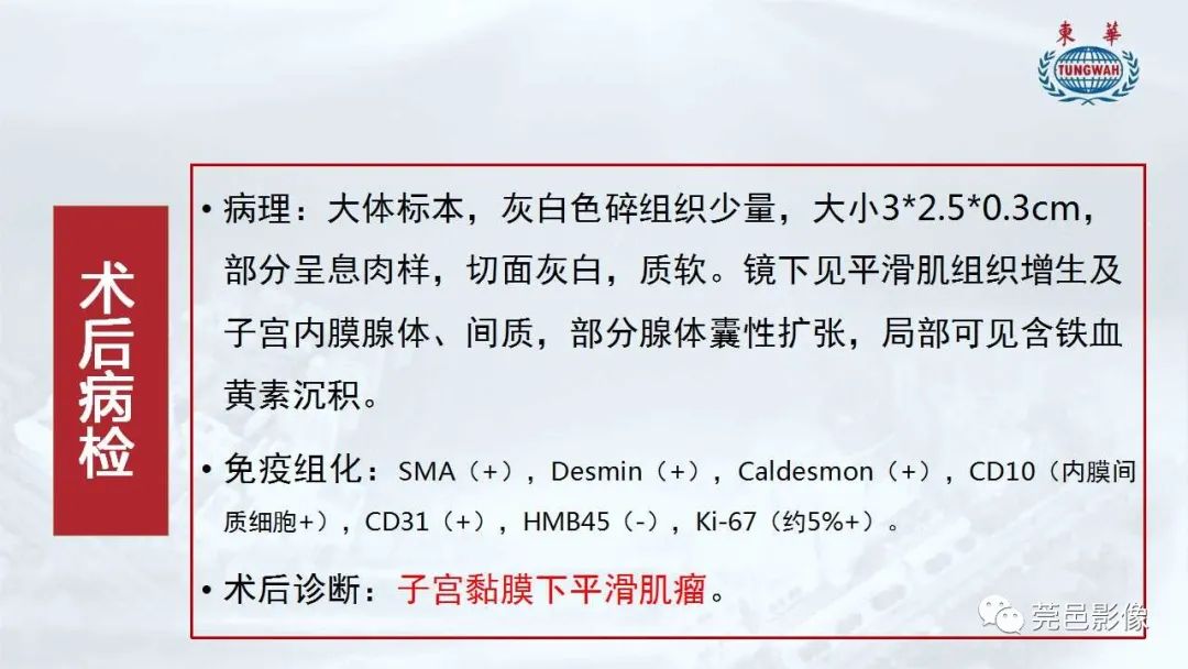 影像PPT - 【病例】一例肺良性转移性平滑肌瘤及文献复习-6