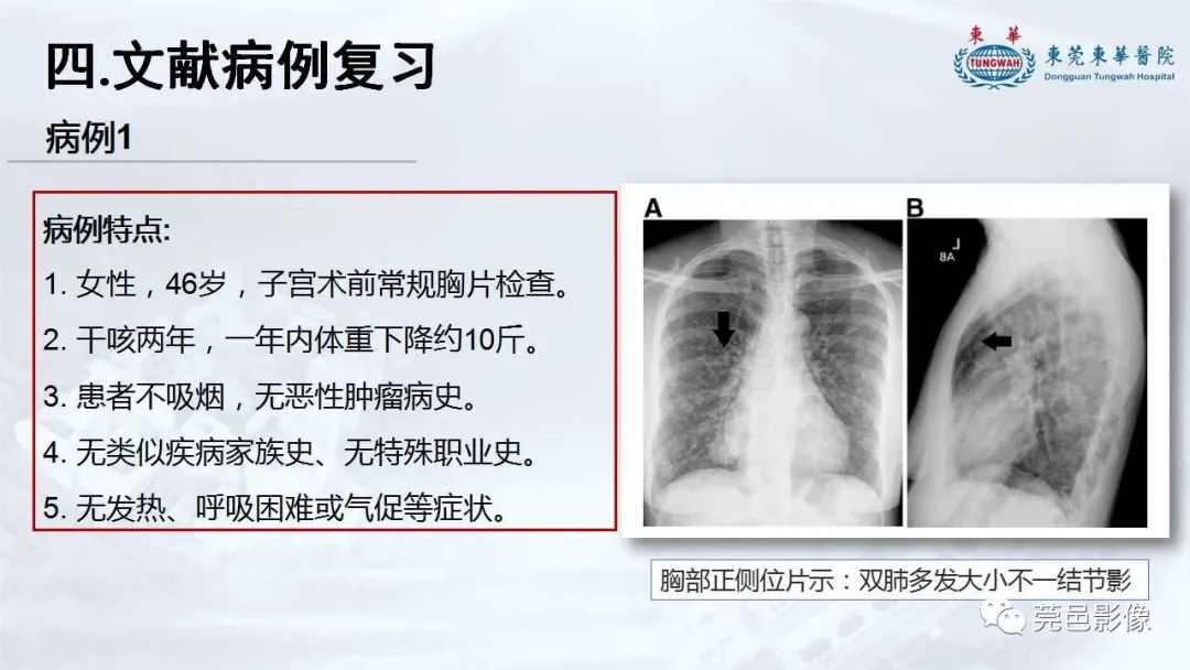 影像PPT - 【病例】一例肺良性转移性平滑肌瘤及文献复习-21