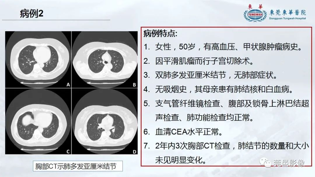 影像PPT - 【病例】一例肺良性转移性平滑肌瘤及文献复习-24