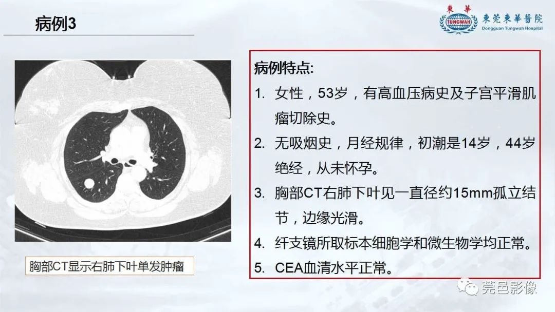 影像PPT - 【病例】一例肺良性转移性平滑肌瘤及文献复习-26